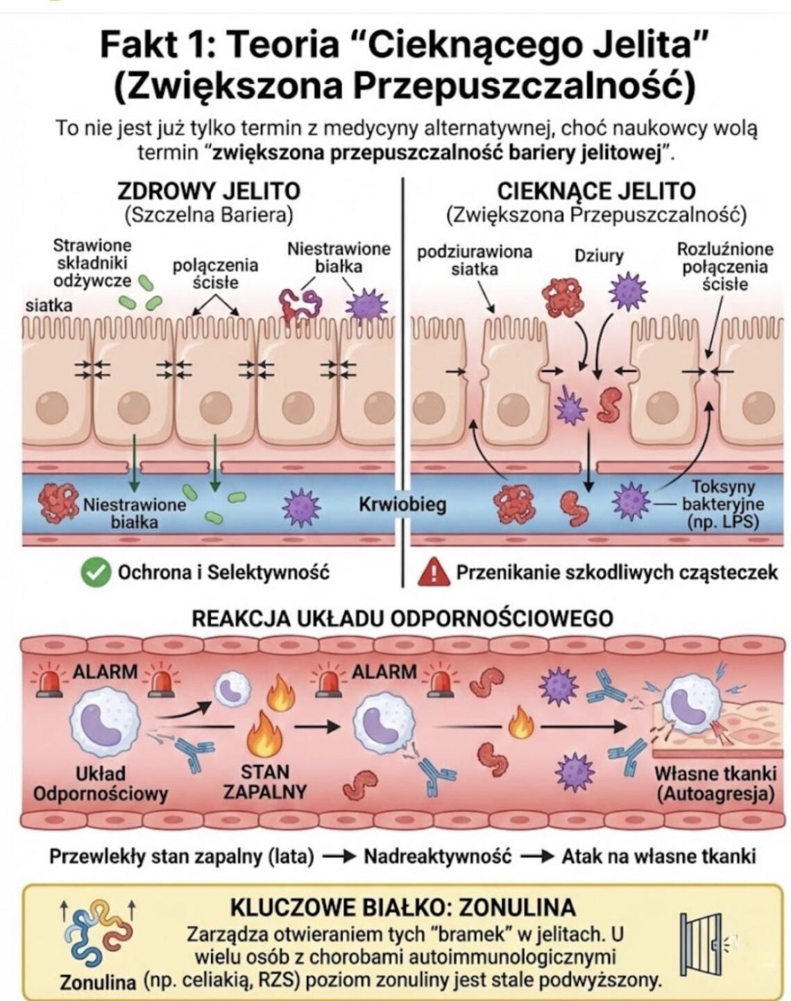 Przeciekające jelito