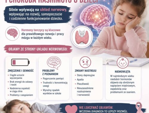 infografika